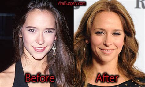 has jennifer love hewitt had plastic surgery|Jennifer Love Hewitt Asks Fans to ‘Be Kind’ After Plastid Surgery ...